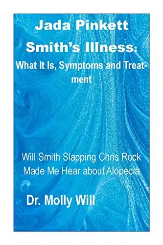 Jada Pinkett Smiths Illness What It Is, Symptoms and Treatment Will Smith Slapping Chris Rock Made Me Hear about Alopecia